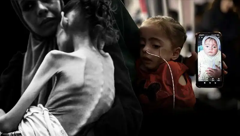 Küçük Meryem'in Dramı: Açlıkla Mücadelede 25 Kilodan 10 Kiloya Düşüş