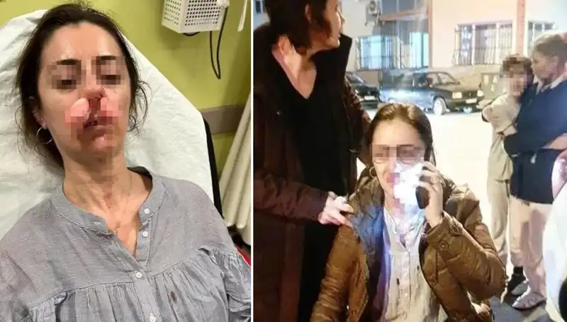 Eşinin Sevgilisini Otomobil Kapısıyla Saldırarak Yaraladı: Şok Edici Olay
