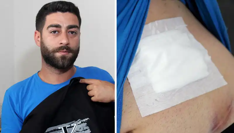 Karnındaki Ağrı, Röntgen Sonucu ile Şok Edici Bir Gerçeği Ortaya Çıkardı