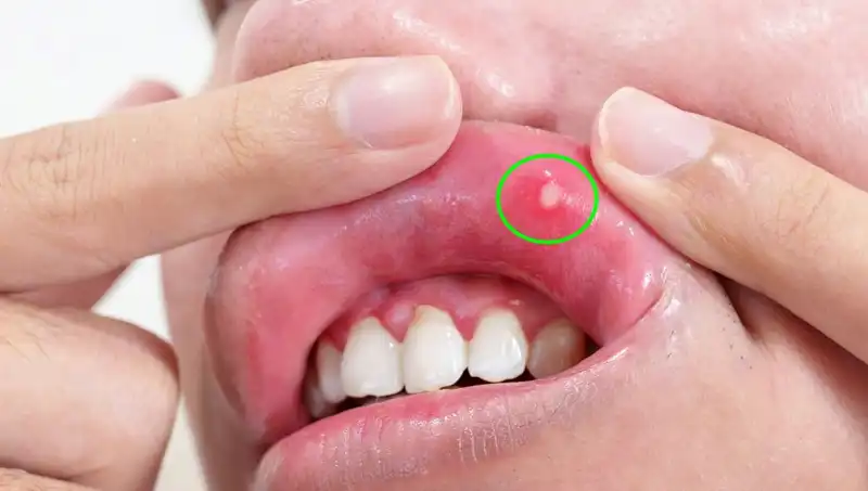 B Vitaminleri Eksikliği: Belirtileri ve Vücuda Etkileri Nelerdir?
